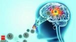 Elderly woman diagnosed with amoebic brain fever in Kallara, Kerala — health officials conduct inspections in the area.
