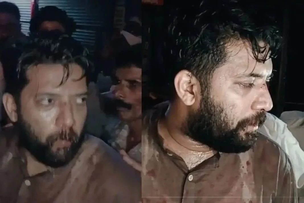 Shafi Parambil, MP, who was injured in police action at Perambra in Kozhikode on Friday evening