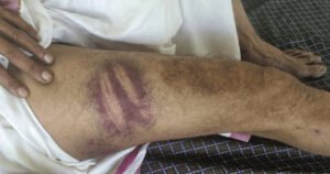 ഓട്ടോ ഡ്രൈവറെ പൊലീസ് മർദിച്ചതായി