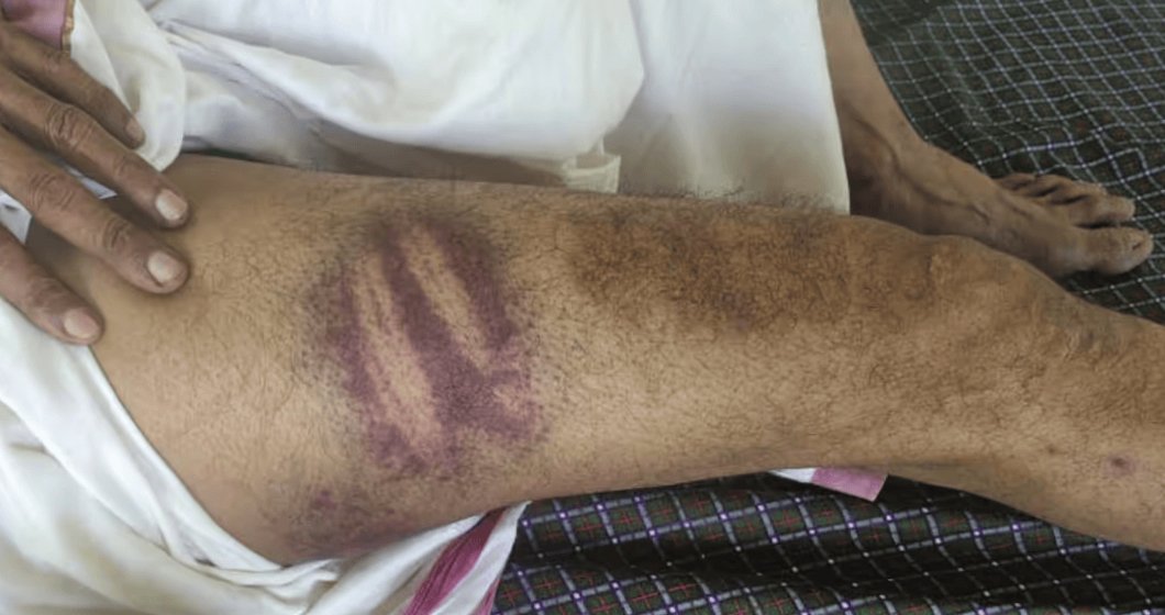 ഓട്ടോ ഡ്രൈവറെ പൊലീസ് മർദിച്ചതായി