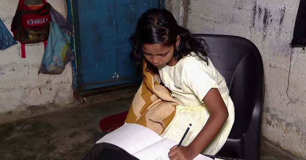 കൃത്രിമകൈ ലഭിച്ചിട്ടില്ല; പുതുവർഷം വന്നിട്ടും സ്കൂളിൽ പോകാൻ കഴിയാതെ വിനോദിനി