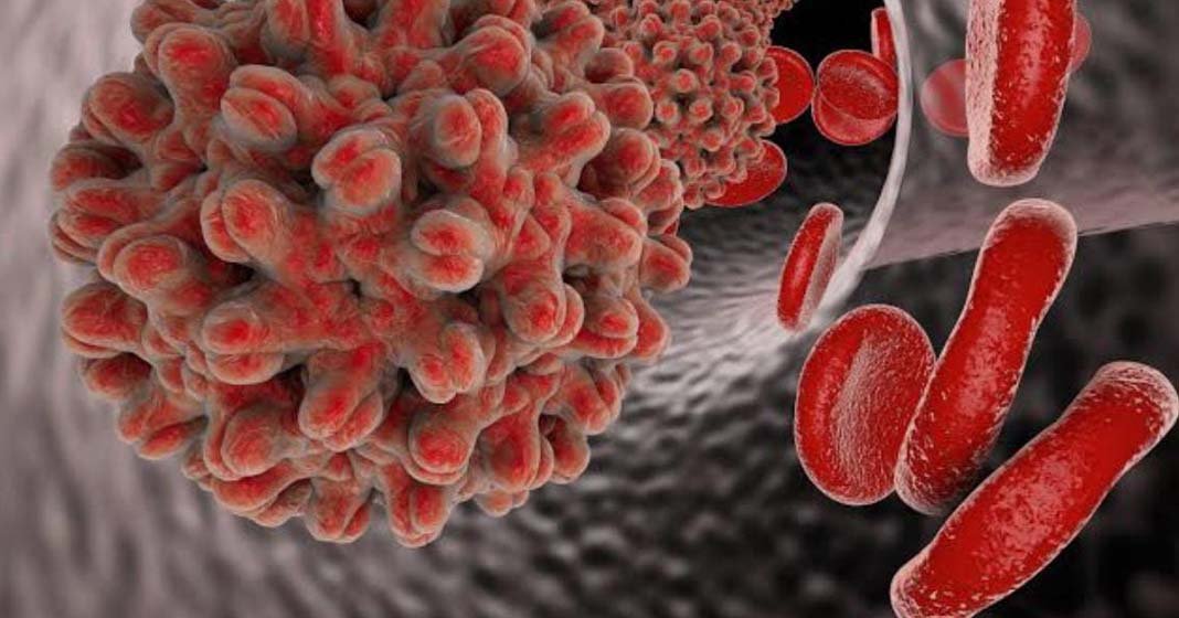 ഈ ഗ്രാമത്തിൽ മഞ്ഞപ്പിത്തം വ്യാപിക്കുമ്പോൾ ഉറവിടം തിരിച്ചറിയാനാകുന്നില്ല ; ആശങ്ക