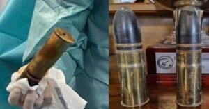 24 കാരന്റെ മലാശയത്തിൽ ഒന്നാം ലോക മഹായുദ്ധകാലത്തെ, പ്രവർത്തനക്ഷമമായ എട്ട് ഇഞ്ച് നീളമുള്ള ഷെൽ..! ആശുപത്രി ഒഴിപ്പിച്ചു, ബോംബ് സ്ക്വാഡ് എത്തി പുറത്തടുത്തു; പിന്നിൽ…..