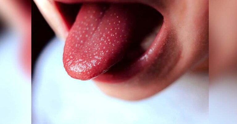 കട്ടപ്പനയിൽ ഒന്നര വയസ്സുകാരിക്ക് അപൂർവ കവാസാക്കി രോഗം സ്ഥിരീകരിച്ചു; കുട്ടികളിലെ കടുത്ത പനിയും ചുവന്ന കണ്ണുകളും നിസ്സാരമാക്കരുത്; ലക്ഷണങ്ങൾ ഇവയാണ്